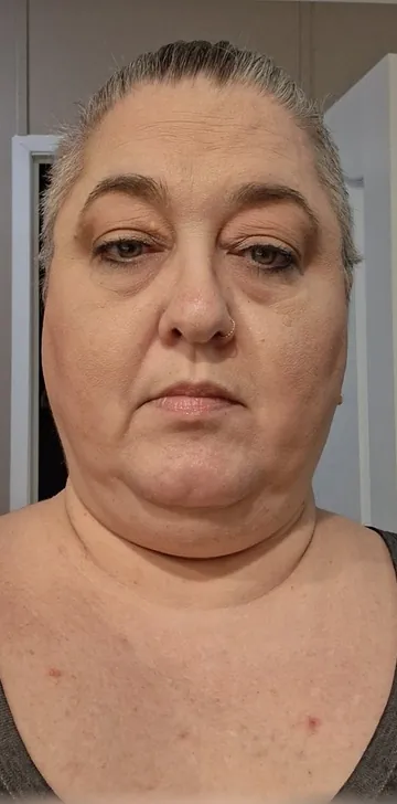 Amanda before